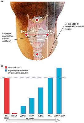 Vagus Nerve Stimulation-Induced Laryngeal Motor Evoked Potentials: A Possible Biomarker of Effective Nerve Activation